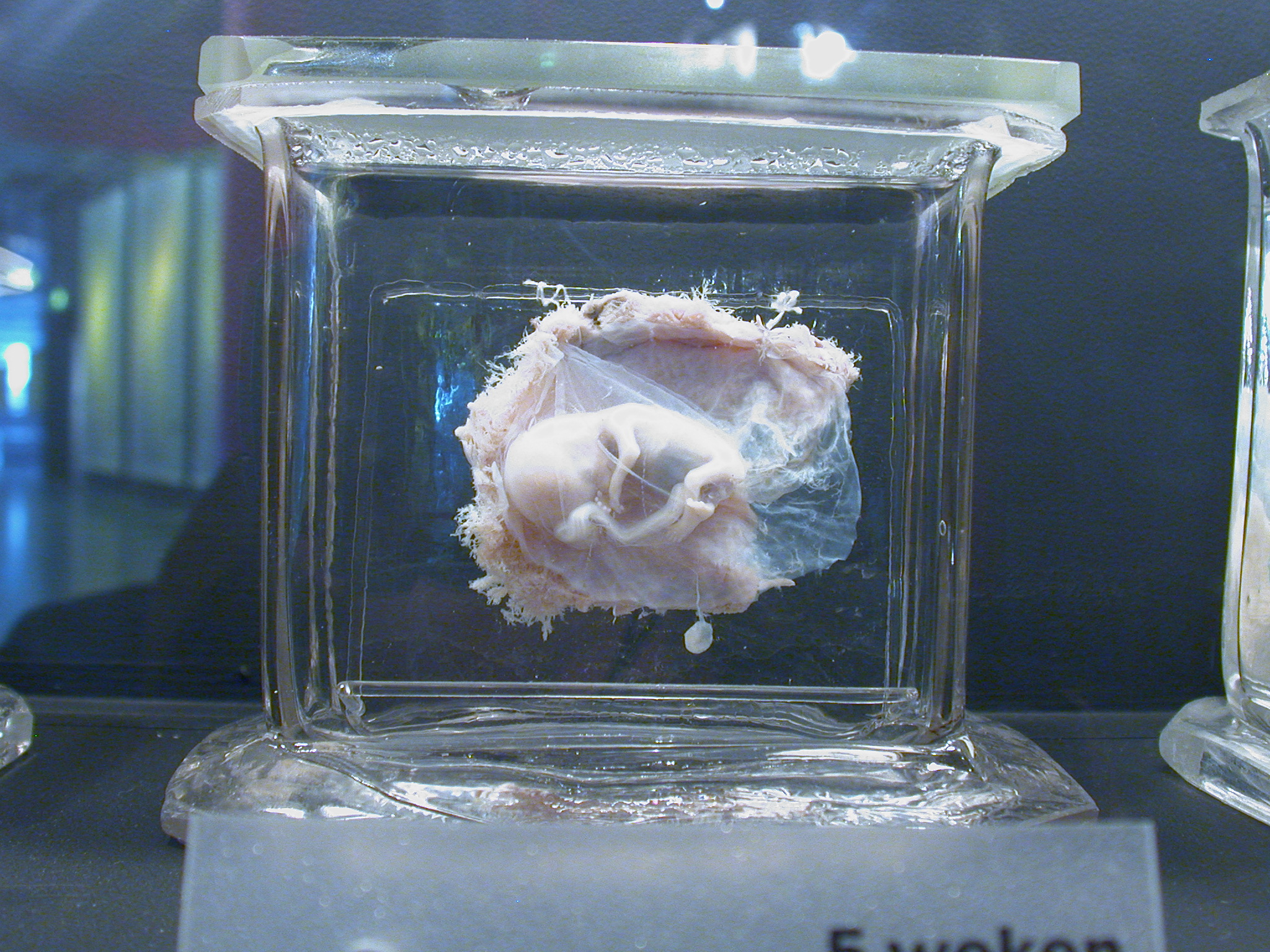 Image*After photos human fetus on strong water liquid jar baby