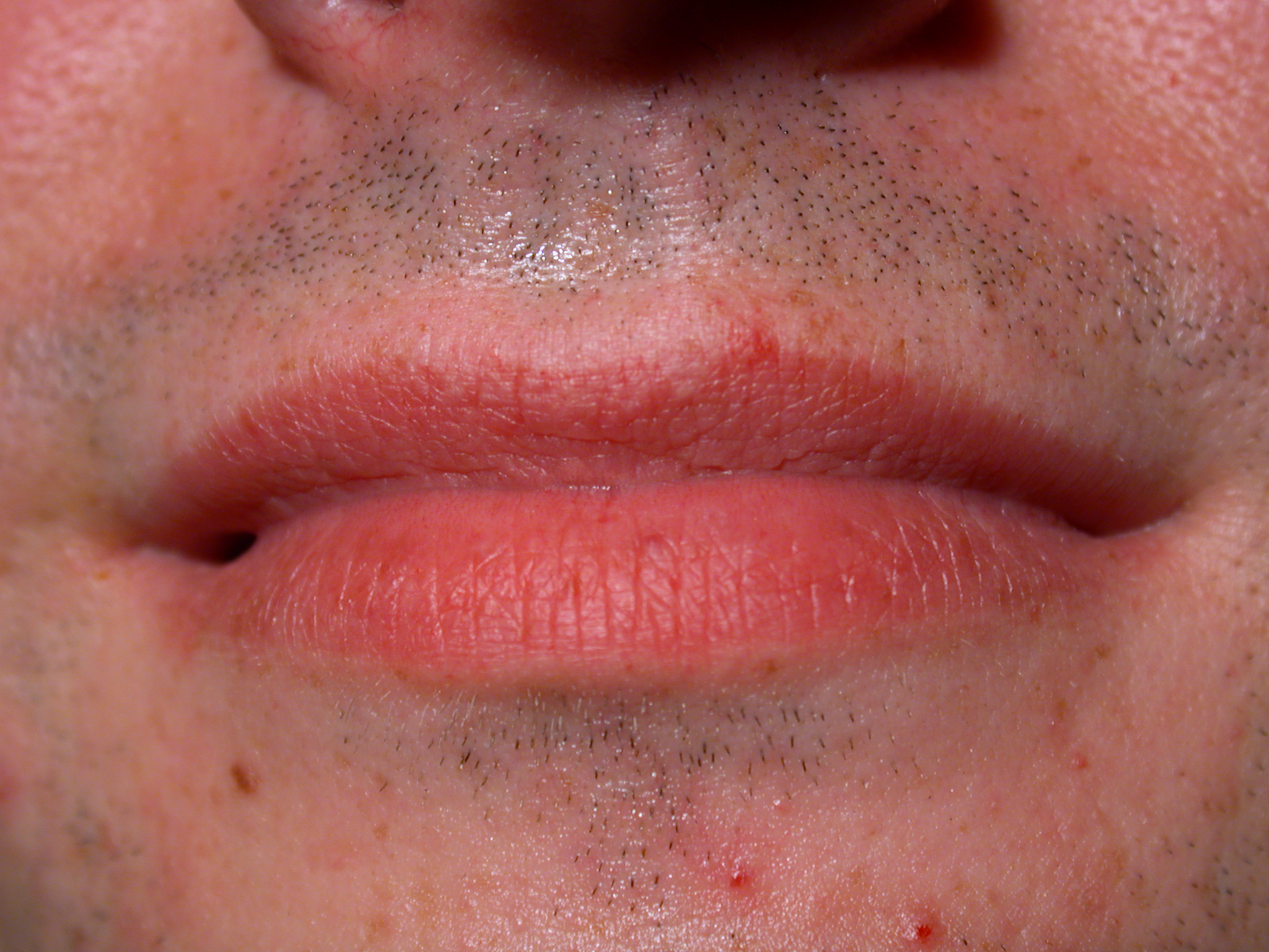 Image*After : image : nature characters humanparts bk1 male texture mouth  lip lips sealed scruff skin