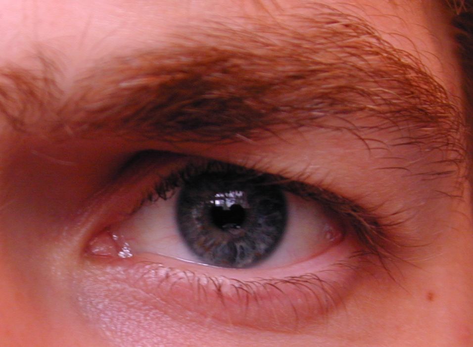 Image*After images eye glassy organ lid brow