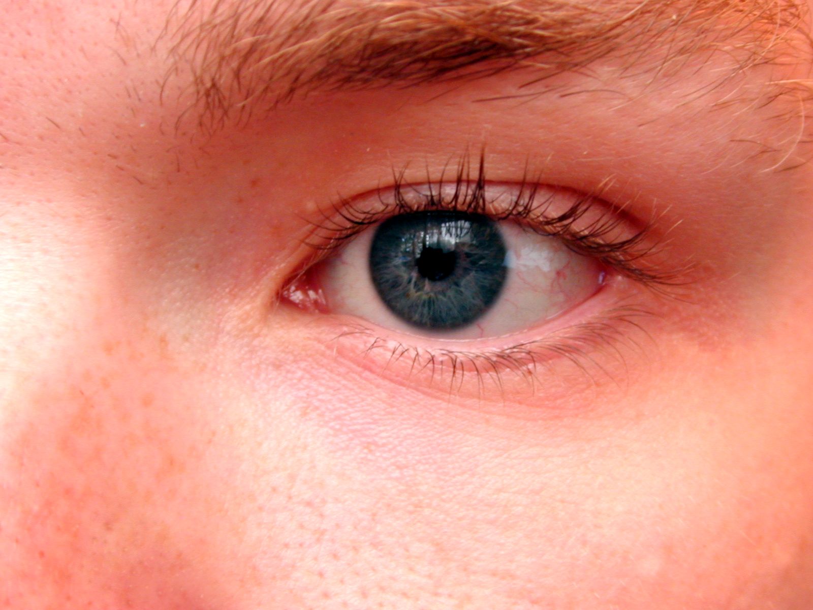 Image*After images eye glassy organ lid brow