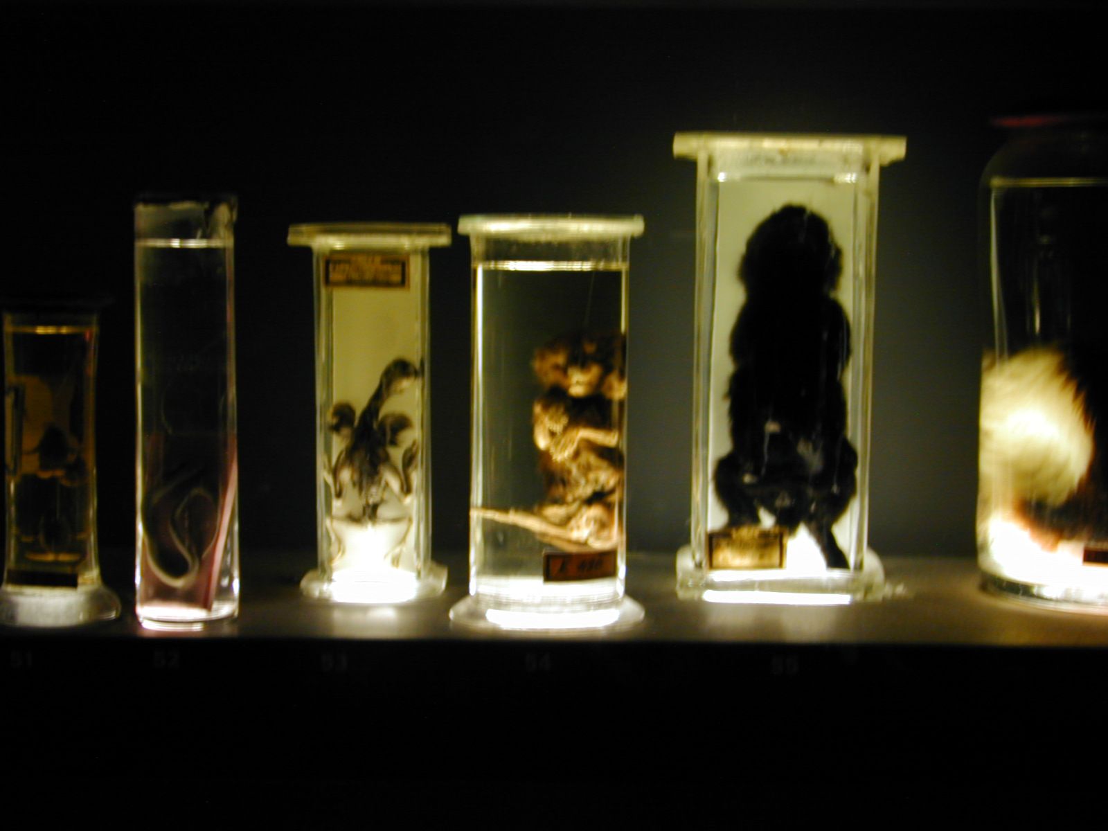 Image*After photos laboratory specimens jars unborn