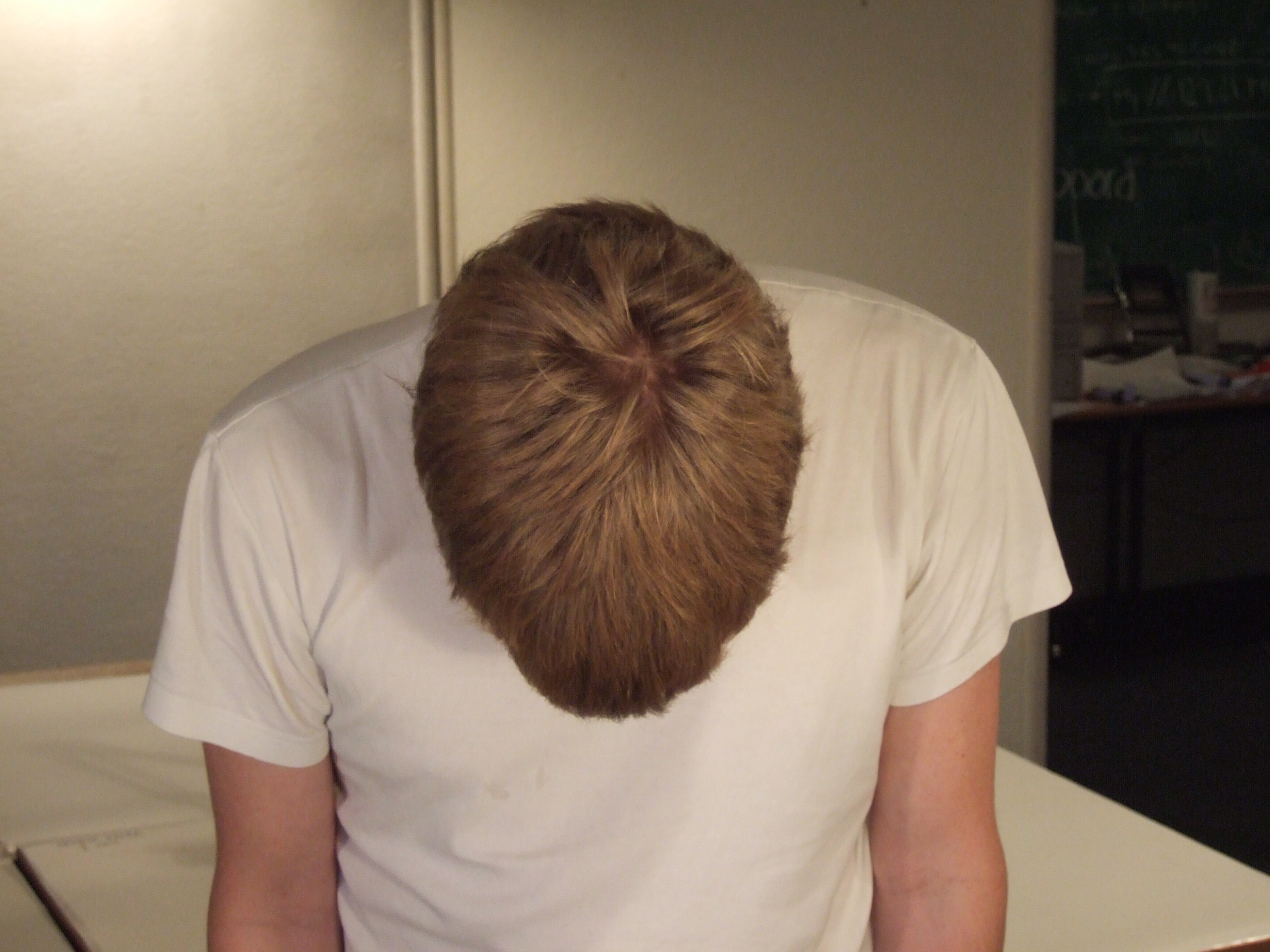Как должна выглядеть макушка Image*After : images : tabus nature characters humanparts head torso hair top de