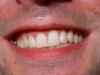 nature characters humanparts bodykit1 smile teeth mouth lips male man