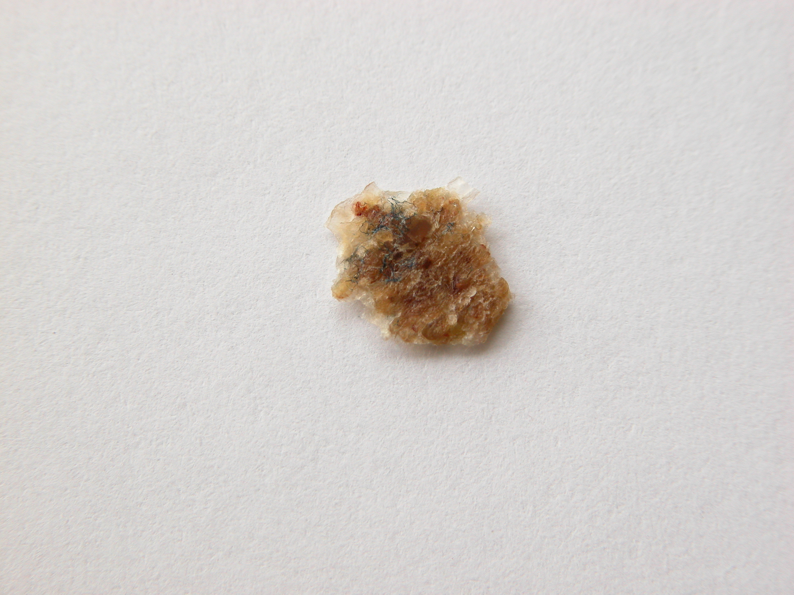 Ring Scab On Skin