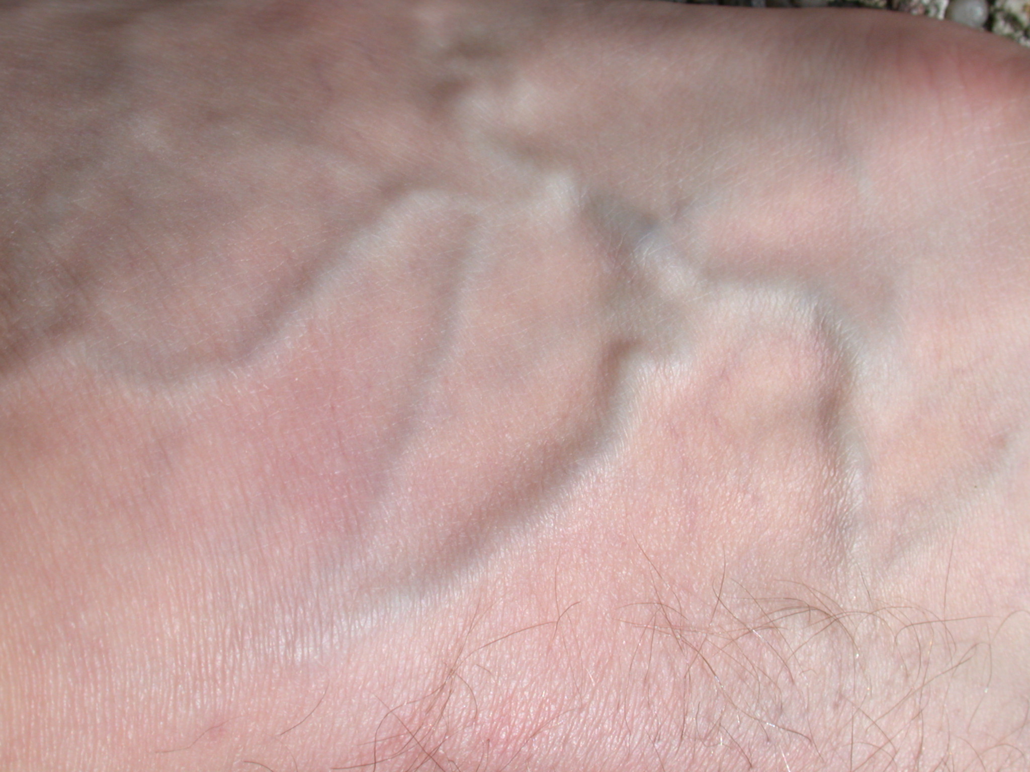 Human Skin Texture And Veins Image After Textures Skin Texture Pink Macro Flesh