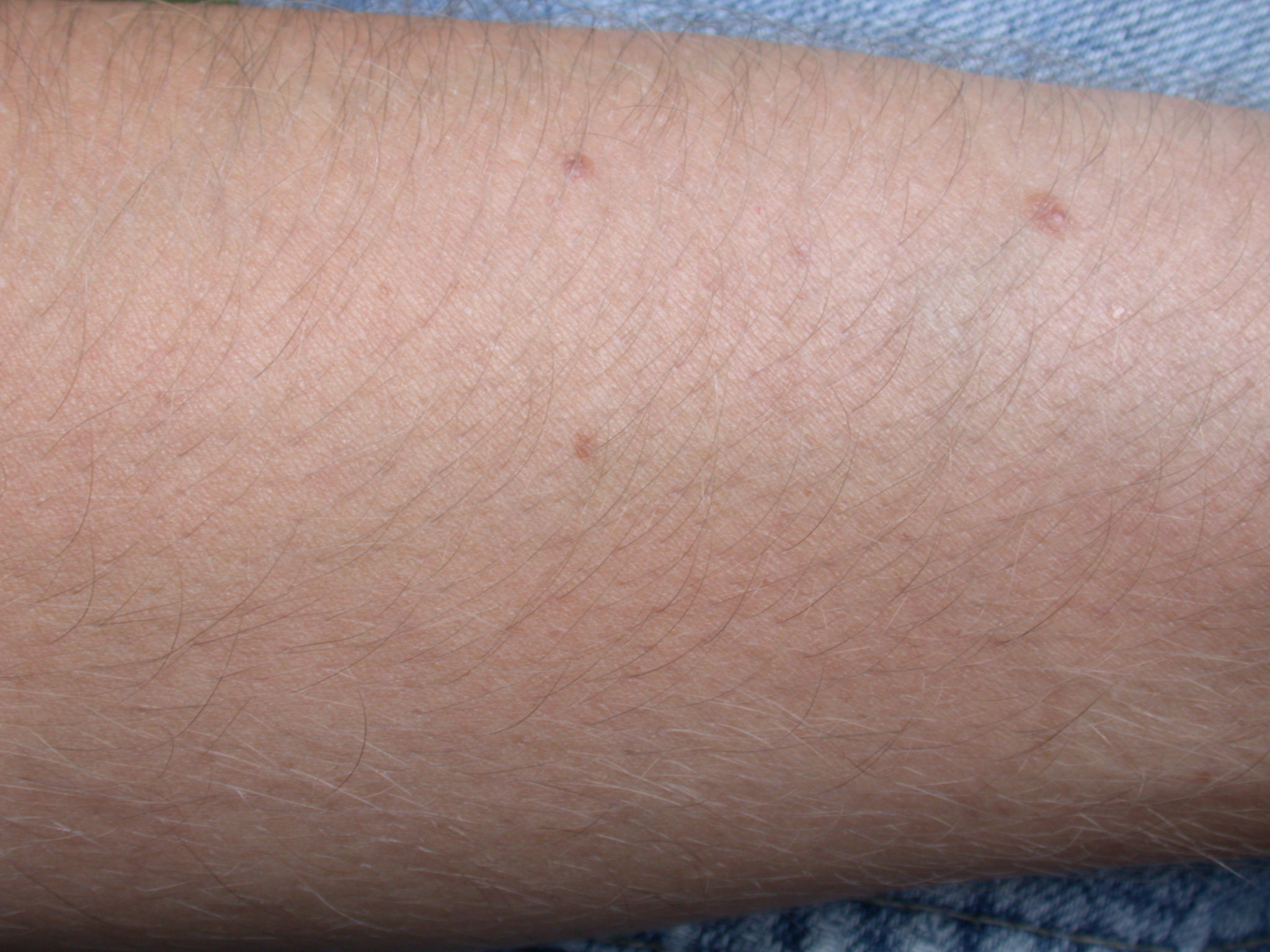 Image*After photo skin texture macro flesh arm hair hairs hairy