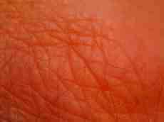 skin closeup wrinkles hairs red maartent
