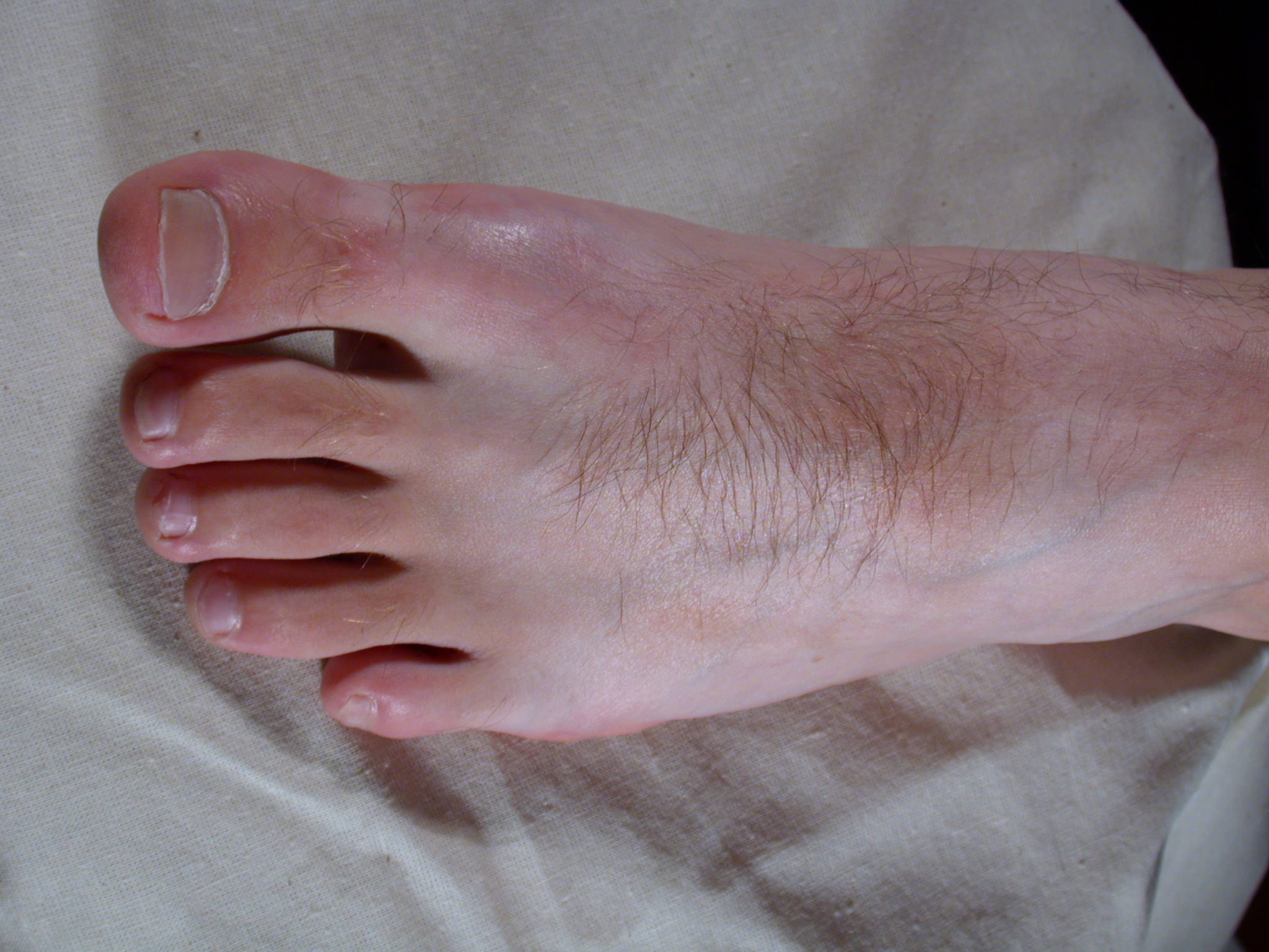 nature characters humanparts male texture reference bodykit1 foot top toe toes nail nails toenail toenails hair hairy skin pink leftfoot