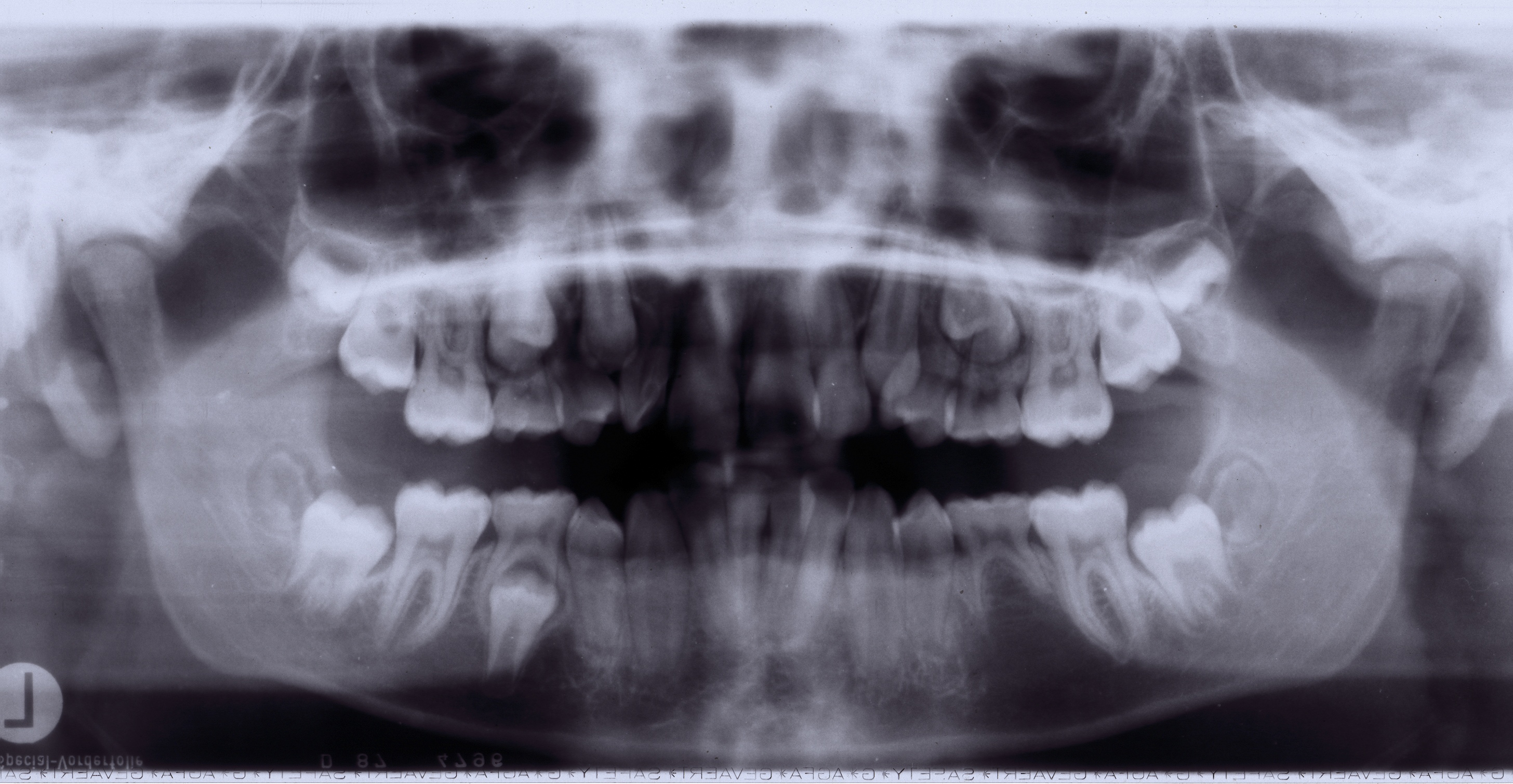 tooth teeth xray nature characters humanparts mouth dentist typo typography numbers agfa gevaert root roots jaw jaws grayscale royalty