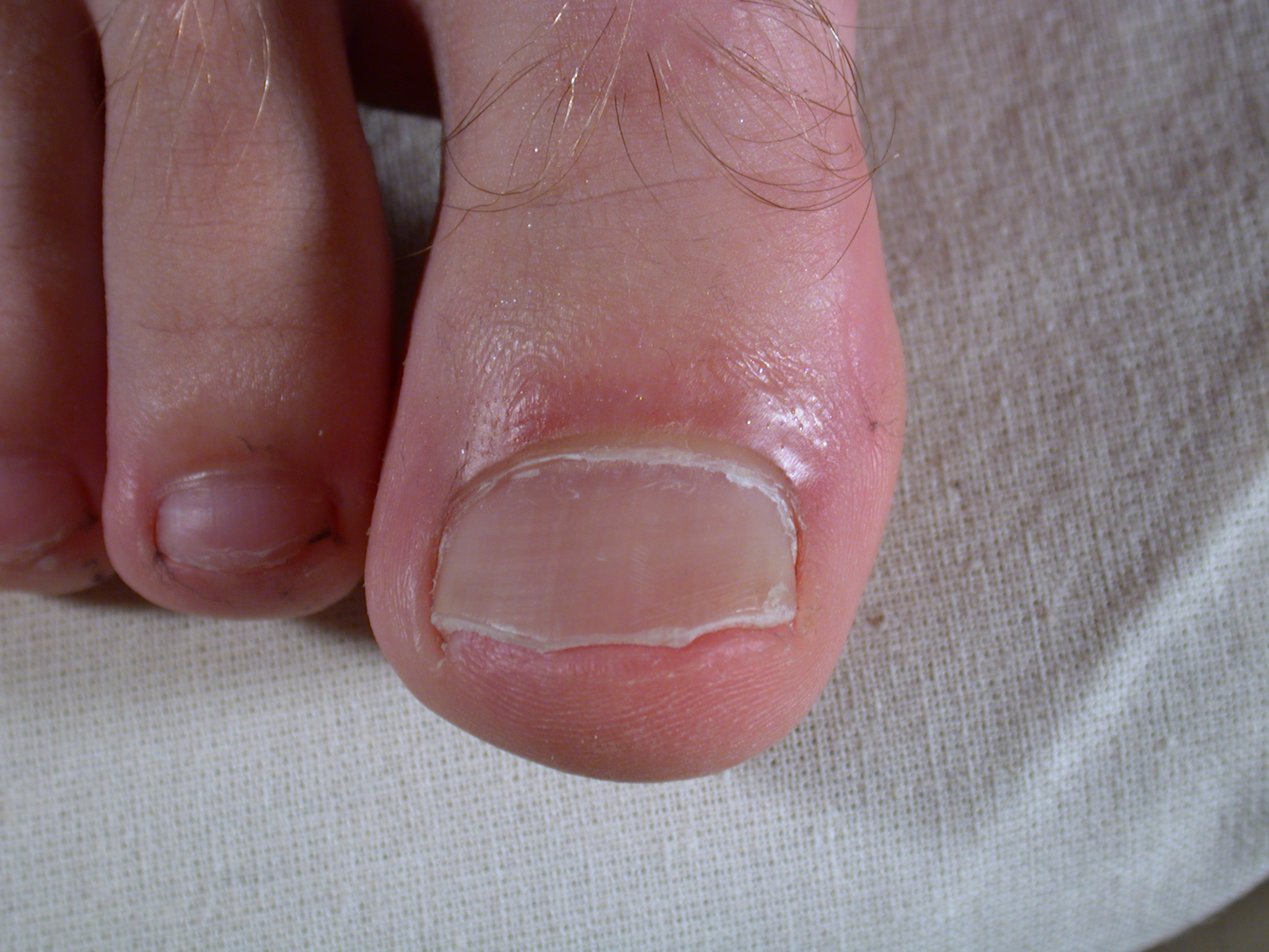 nature characters humanparts bigtoe toe nail toenail toes foot male rightfoot bodykit1 bk1