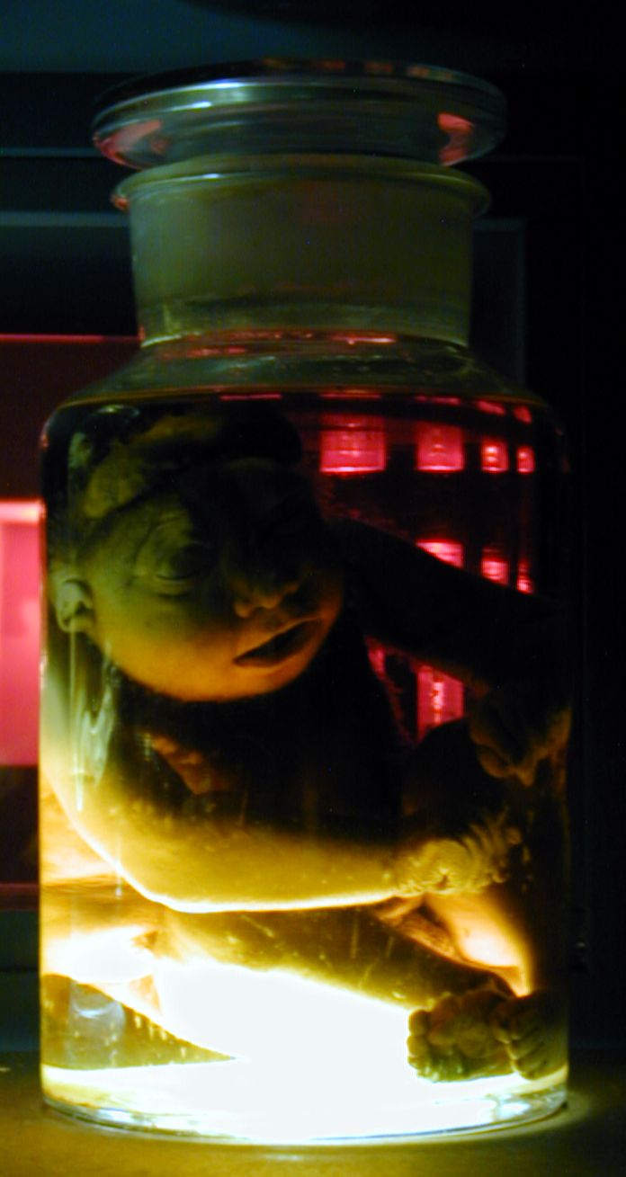 laboratory specimen jars unborn baby
