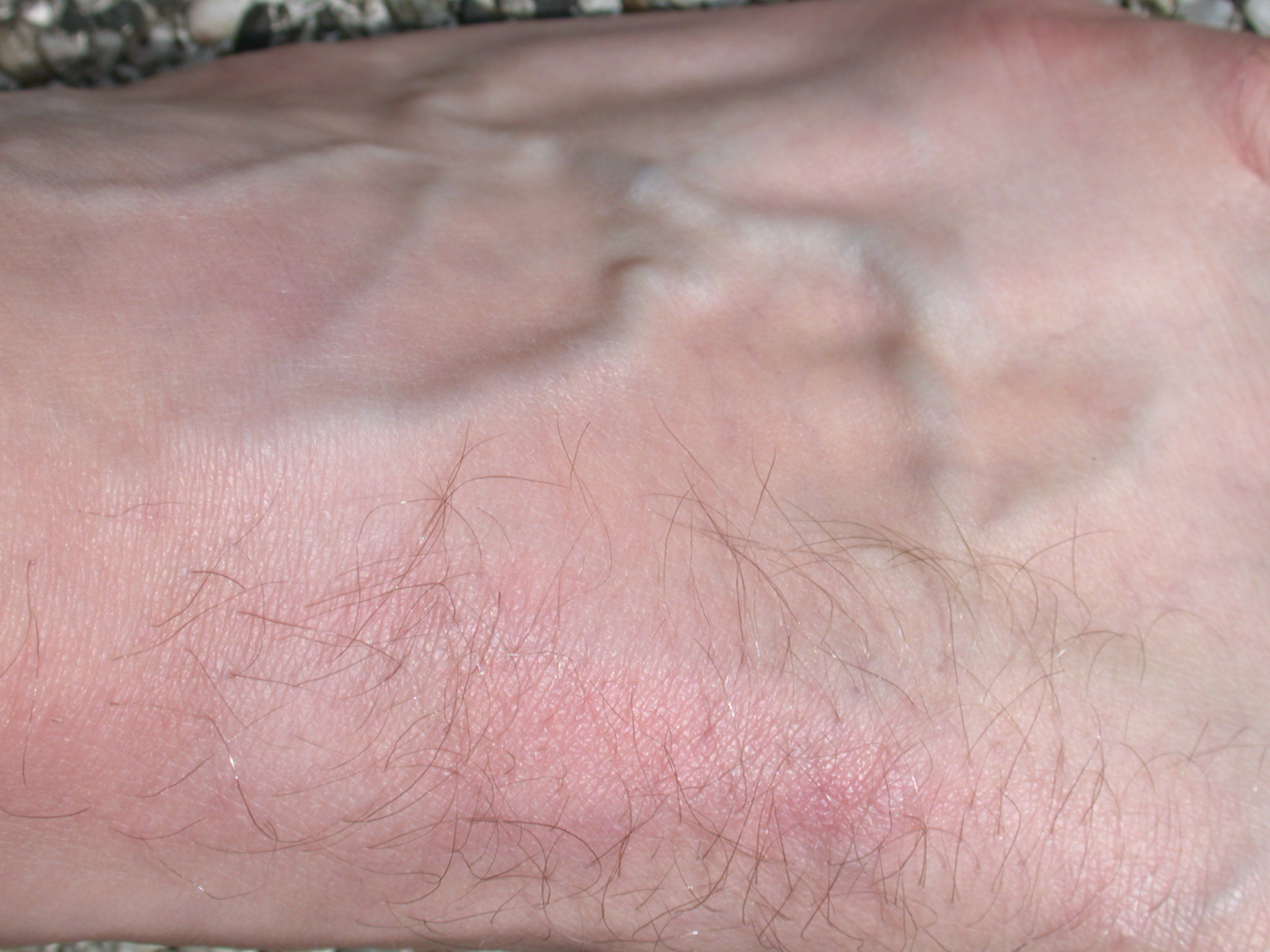 skin texture pink macro flesh vein veins foot top hair hairy hairs