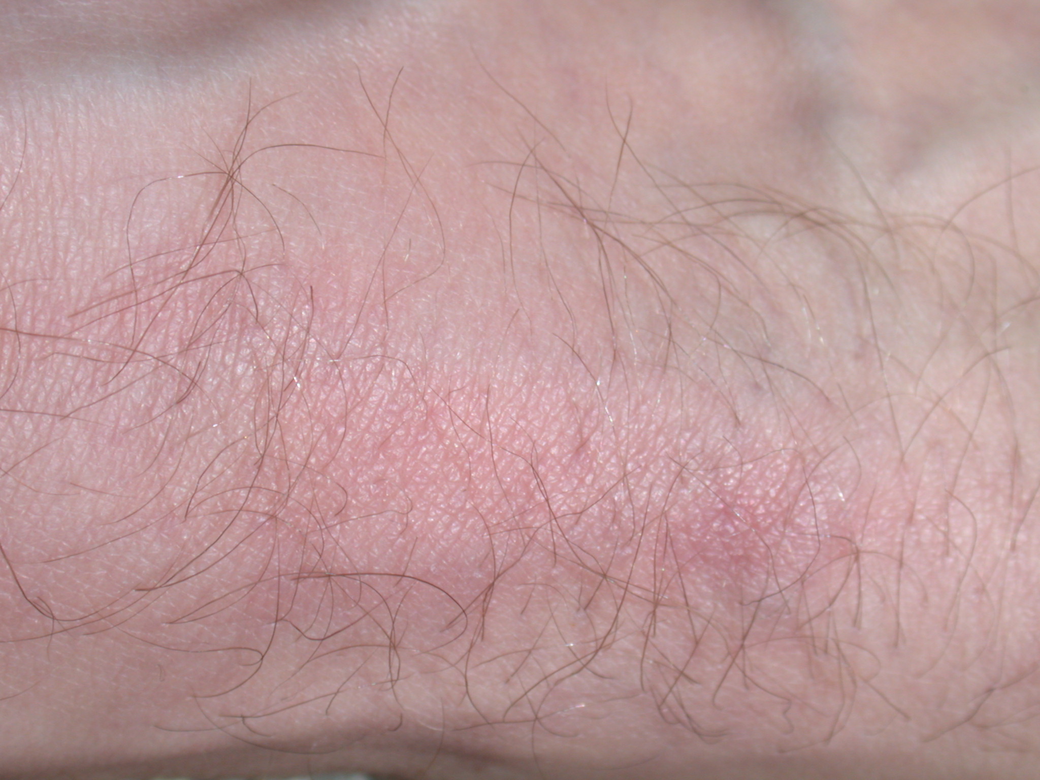 skin texture pink macro flesh foot top hair hairy hairs vein veins royalty-free
