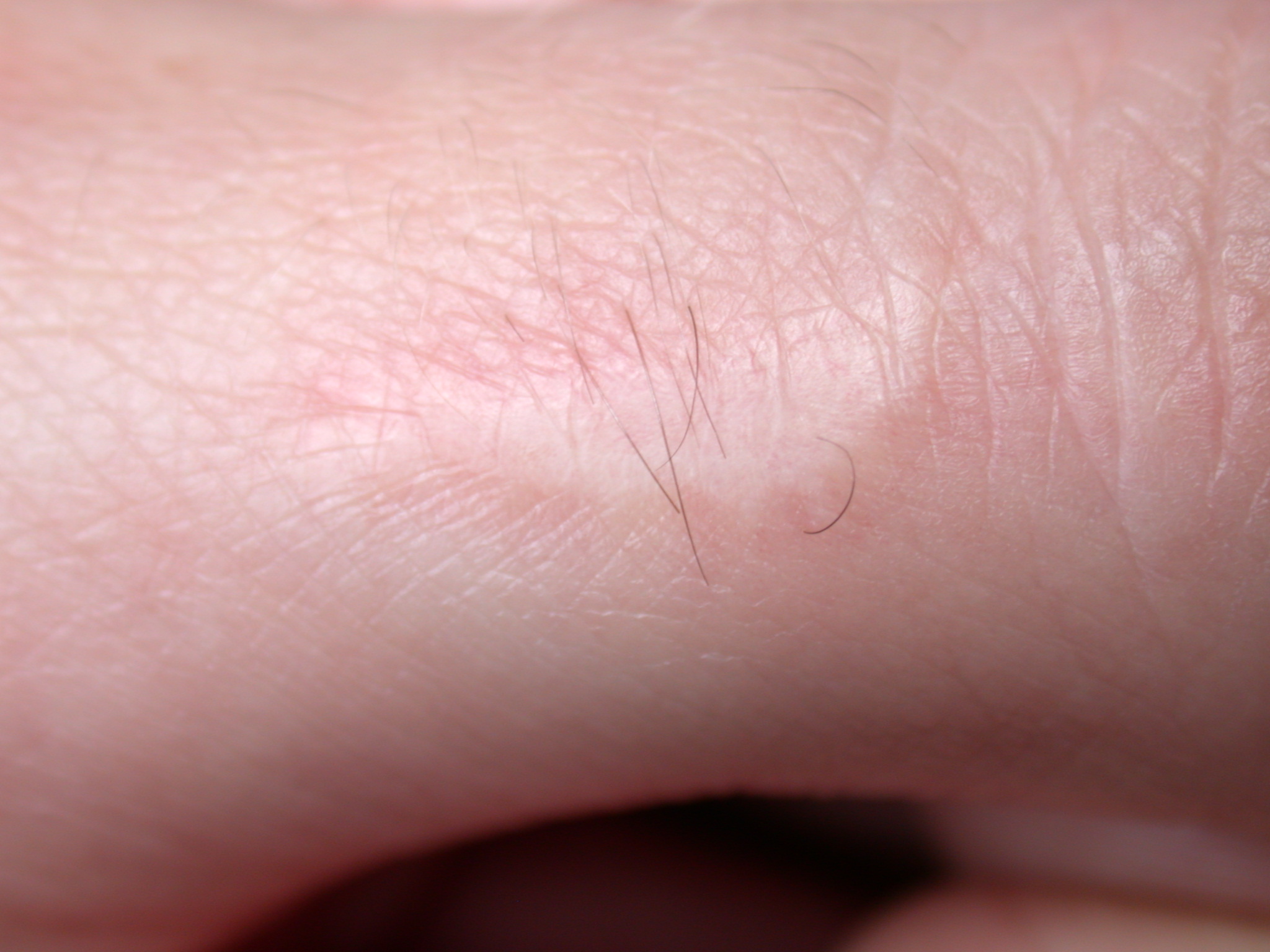 skin texture pink macro flesh scar scarrification thumb finger hand hair hairy