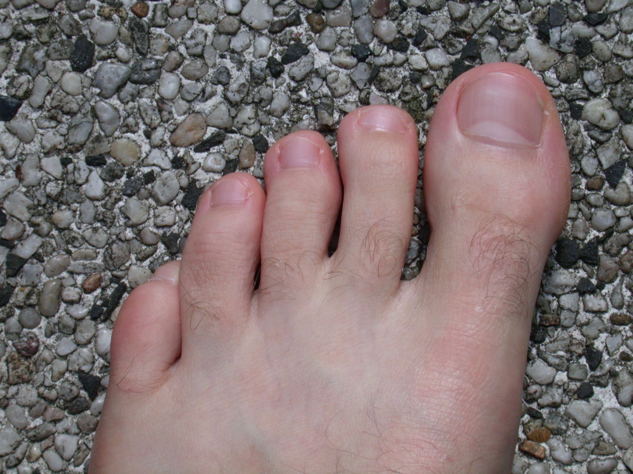 foot skin texture hair top flesh vein toe toes nail nails toenail toenails nature characters humanparts male