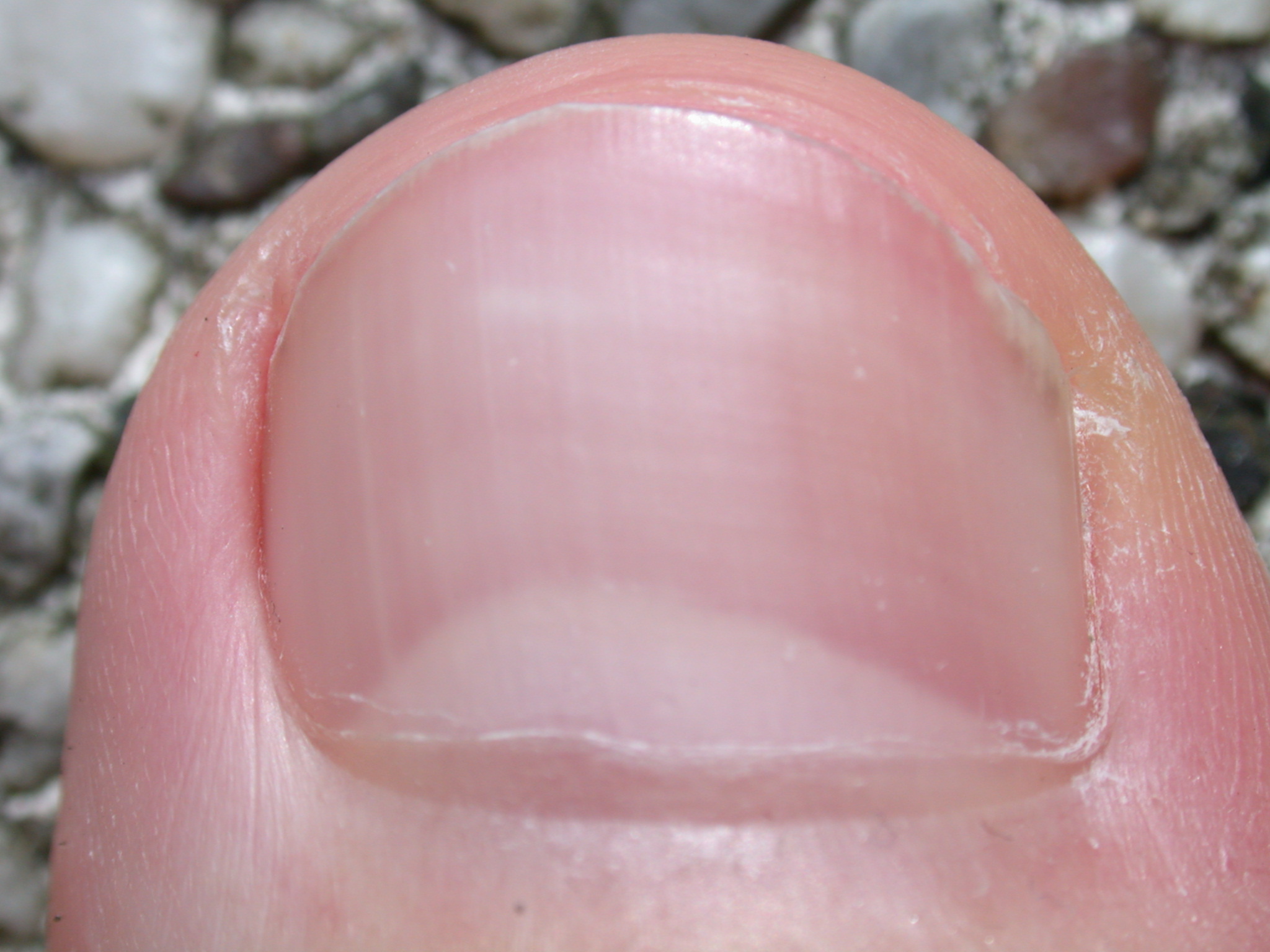 toenail bigtoe texture nail macro pink nature characters humanparts male