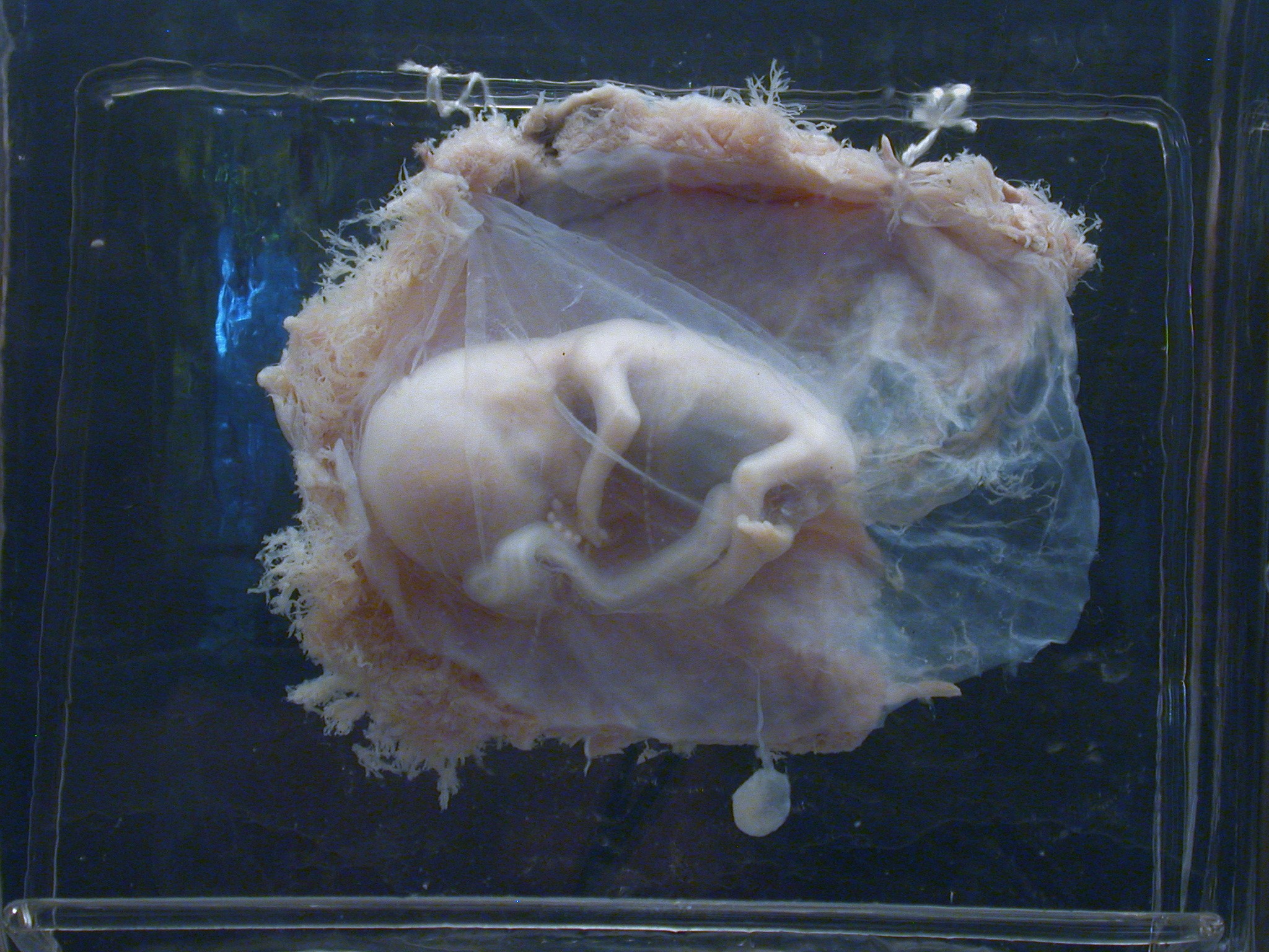 placenta embryo baby unborn lab laboratory nature characters humanoids side