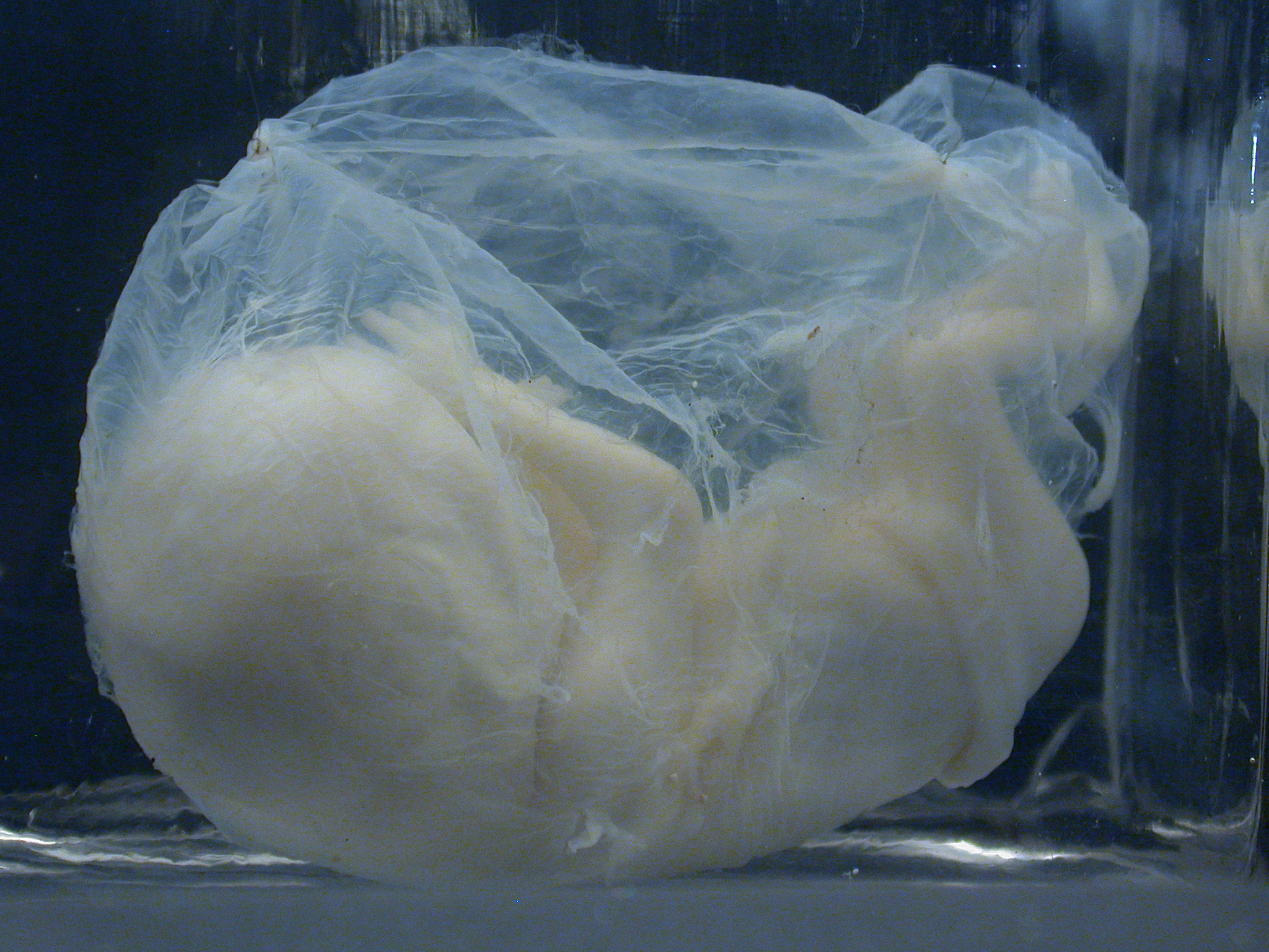 fetus human embryo baby
